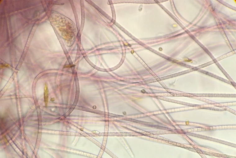Cyanobacteria microscope details
