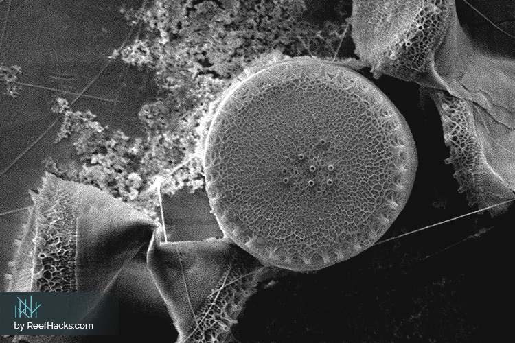 Phytoplankton under the microscope